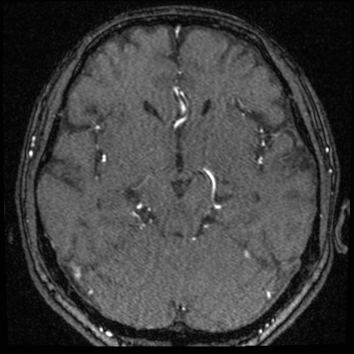 Click on the Serie image to view the images of VILLANUEVA, WILLIAM A.